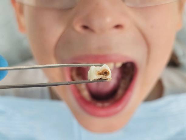 Best Tooth Pain Emergency Relief  in June Park, FL