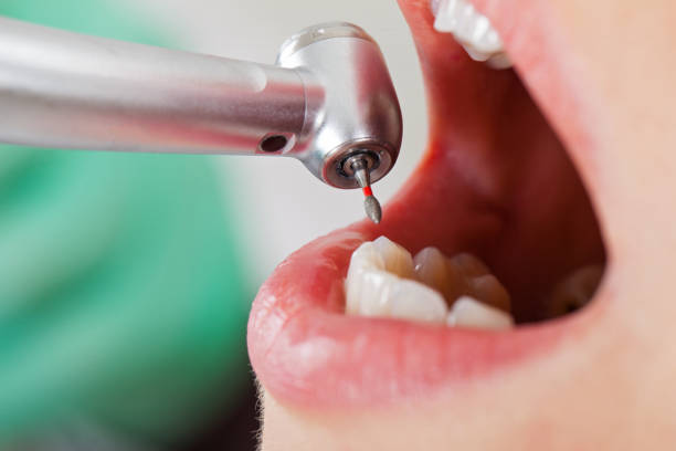 Best Urgent Tooth Repair  in June Park, FL